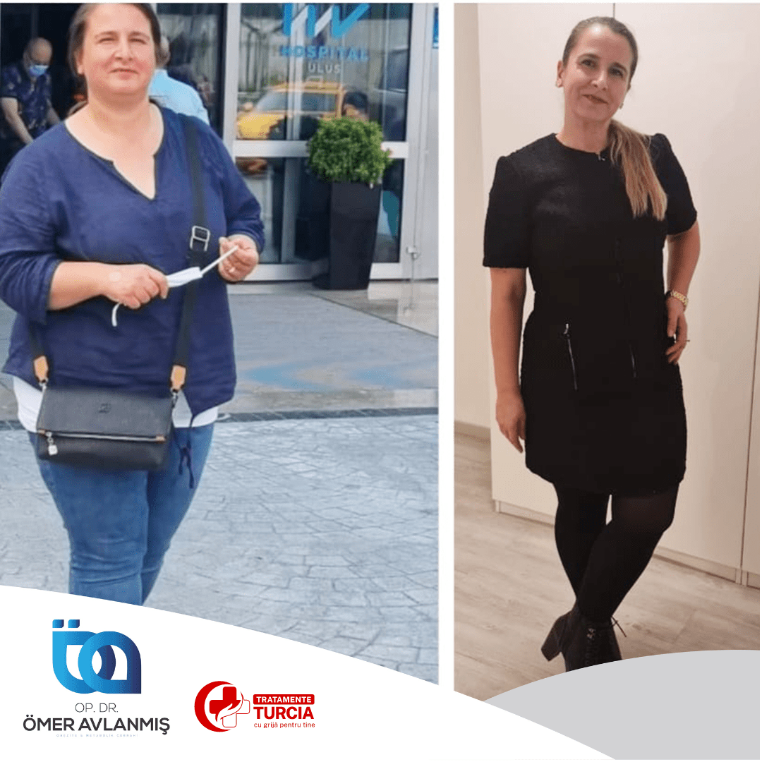 Rezultat pacient — înainte și după