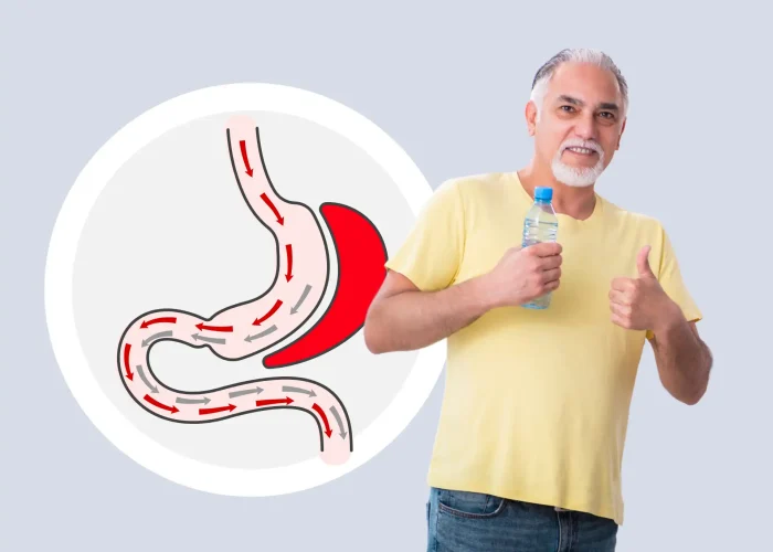 Gastric Sleeve