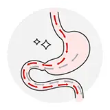 Reprezentare grafică — stomacul normal vs. balon gastric introdus